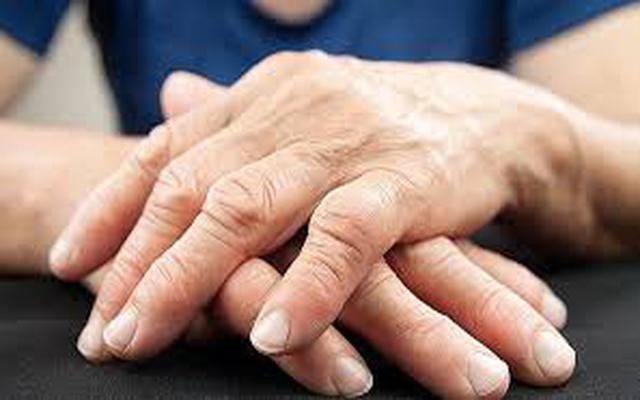 Actividades por el Día Mundial de la Artritis Reumatoidea.