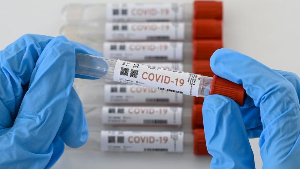 COVID-19 en Córdoba: confirmaron 519 casos nuevos y 21 fallecimientos